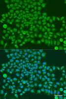 Immunofluorescence analysis of U2OS cells using TARDBP Polyclonal Antibody at dilution of 1:100. Blue: DAPI for nuclear staining.