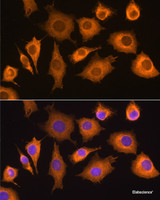 Immunofluorescence analysis of L929 cells using RIG-I / DDX58 Polyclonal Antibody at dilution of 1:100. Blue: DAPI for nuclear staining.