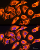 Immunofluorescence analysis of U20S cells using RIG-I / DDX58 Polyclonal Antibody at dilution of 1:100. Blue: DAPI for nuclear staining.