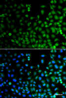 Immunofluorescence analysis of A549 cells using LHX6 Polyclonal Antibody