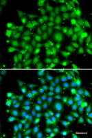 Immunofluorescence analysis of MCF-7 cells using SUFU Polyclonal Antibody