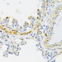 Immunohistochemistry of paraffin-embedded Rat lung using Cytochrome c Polyclonal Antibody at dilution of 1:100 (40x lens) .
