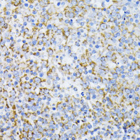 Immunohistochemistry of paraffin-embedded Human tonsil using Cytochrome c Polyclonal Antibody at dilution of 1:100 (40x lens) .