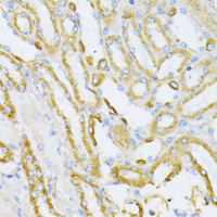 Immunohistochemistry of paraffin-embedded Mouse kidney using Cytochrome c Polyclonal Antibody at dilution of 1:100 (40x lens) .