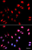 Immunofluorescence analysis of U2OS cells using RAD18 Polyclonal Antibody