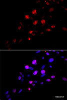 Immunofluorescence analysis of U2OS cells using RAD18 Polyclonal Antibody