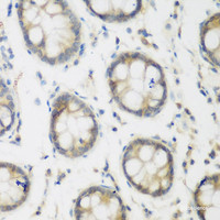 Immunohistochemistry of paraffin-embedded Human colon using ACCS Polyclonal Antibody at dilution of 1:200 (40x lens) .