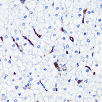 Immunohistochemistry of paraffin-embedded Human liver using HO-1 Polyclonal Antibody at dilution of 1:200 (40x lens) .