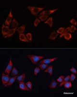 Immunofluorescence analysis of HeLa cells using HO-1 Polyclonal Antibody at dilution of 1:100 (40x lens) . Blue: DAPI for nuclear staining.