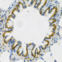 Immunohistochemistry of paraffin-embedded Rat lung using AK1 Polyclonal Antibody at dilution of 1:100 (40x lens) .