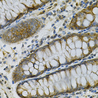 Immunohistochemistry of paraffin-embedded Human colon using AK1 Polyclonal Antibody at dilution of 1:100 (40x lens) .