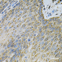 Immunohistochemistry of paraffin-embedded Human esophagus using AK1 Polyclonal Antibody at dilution of 1:100 (40x lens) .
