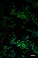 Immunofluorescence analysis of HeLa cells using AK1 Polyclonal Antibody