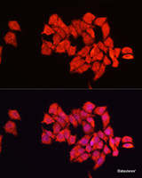 Immunofluorescence analysis of HeLa cells using ALDH2 Polyclonal Antibody at dilution of 1:100. Blue: DAPI for nuclear staining.