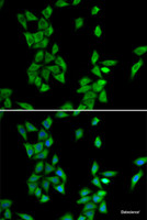 Immunofluorescence analysis of HeLa cells using ANXA4 Polyclonal Antibody