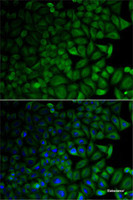 Immunofluorescence analysis of HeLa cells using CD1D Polyclonal Antibody