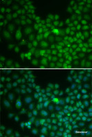 Immunofluorescence analysis of U2OS cells using CLU Polyclonal Antibody