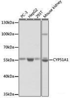Western blot analysis of extracts of various cell lines using CYP51A1 Polyclonal Antibody at dilution of 1:1000.
