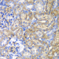 Immunohistochemistry of paraffin-embedded Rat kidney using EHHADH Polyclonal Antibody at dilution of 1:100 (40x lens) .