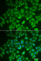Immunofluorescence analysis of A549 cells using EHHADH Polyclonal Antibody