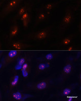 Immunofluorescence analysis of U-251MG cells using FBL Polyclonal Antibody at dilution of 1:100. Blue: DAPI for nuclear staining.