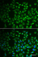Immunofluorescence analysis of A549 cells using FABP6 Polyclonal Antibody