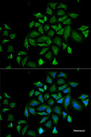 Immunofluorescence analysis of HeLa cells using FGFR1 Polyclonal Antibody