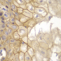 Immunohistochemistry of paraffin-embedded Human esophagus using IL7R Polyclonal Antibody at dilution of 1:100 (40x lens) .