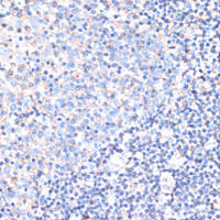 Immunohistochemistry of paraffin-embedded Human tonsil using CD44 Polyclonal Antibody at dilution of 1:200 (40x lens) .