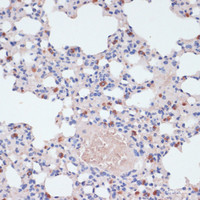 Immunohistochemistry of paraffin-embedded Mouse lung using LYZ Polyclonal Antibody at dilution of 1:100 (40x lens) .