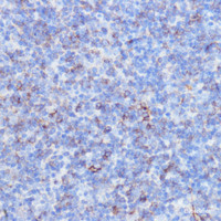 Immunohistochemistry of paraffin-embedded Mouse spleen using NOTCH3 Polyclonal Antibody at dilution of 1:100 (40x lens) .