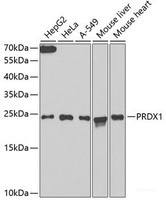 Western blot analysis of extracts of various cell lines using PRDX1 Polyclonal Antibody at dilution of 1:1000.