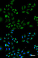 Immunofluorescence analysis of HeLa cells using PRDX1 Polyclonal Antibody