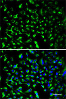 Immunofluorescence analysis of HeLa cells using PHB Polyclonal Antibody