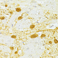 Immunohistochemistry of paraffin-embedded Rat brain using PVALB Polyclonal Antibody at dilution of 1:100 (40x lens) .