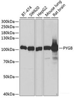 Western blot analysis of extracts of various cell lines using PYGB Polyclonal Antibody at dilution of 1:1000.