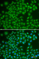 Immunofluorescence analysis of MCF-7 cells using RAB4A Polyclonal Antibody