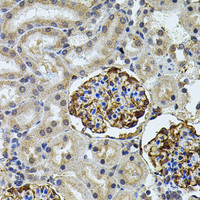 Immunohistochemistry of paraffin-embedded Rat kidney using CETP Polyclonal Antibody