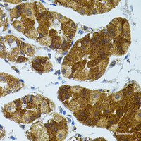 Immunohistochemistry of paraffin-embedded Human stomach using CETP Polyclonal Antibody