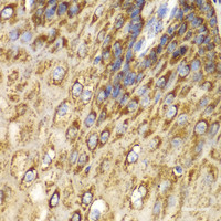 Immunohistochemistry of paraffin-embedded Human esophagus using UGDH Polyclonal Antibody at dilution of 1:100 (40x lens) .