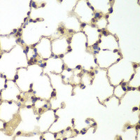 Immunohistochemistry of paraffin-embedded Mouse lung using USF1 Polyclonal Antibody at dilution of 1:200 (40x lens) .
