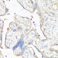 Immunohistochemistry of paraffin-embedded Human placenta using VTN Polyclonal Antibody at dilution of 1:100 (40x lens) .