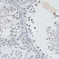 Immunohistochemistry of paraffin-embedded Rat testis using USP7 Polyclonal Antibody at dilution of 1:100 (40x lens) .