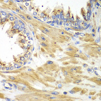 Immunohistochemistry of paraffin-embedded Human prostate using PICK1 Polyclonal Antibody at dilution of 1:100 (40x lens) .