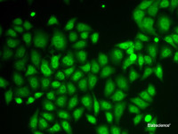 Immunofluorescence analysis of HeLa cells using AKR1A1 Polyclonal Antibody