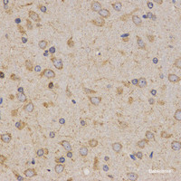 Immunohistochemistry of paraffin-embedded Rat brain using Eif2ak2 Polyclonal Antibody at dilution of 1:200 (40x lens) .