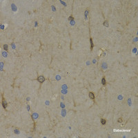 Immunohistochemistry of paraffin-embedded Rat brain using WNT3A Polyclonal Antibody at dilution of 1:200 (40x lens) .