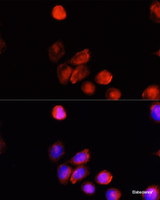 Immunofluorescence analysis of HeLa cells using TYR Polyclonal Antibody at dilution of 1:100 (40x lens) . Blue: DAPI for nuclear staining.