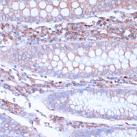Immunohistochemistry of paraffin-embedded Human colon using CD38 Polyclonal Antibody at dilution of 1:100 (40x lens) .