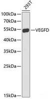 Western blot analysis of extracts of 293T cells using FIGF Polyclonal Antibody at dilution of 1:1000.